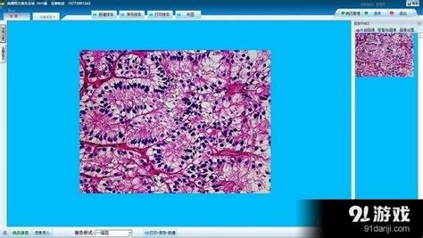 病理图像分析软件(病理图像分析软件有哪些)缩略图