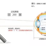 测近视度数的软件(测近视度数的软件有哪些)缩略图