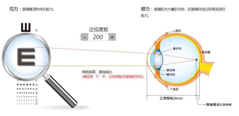 测近视度数的软件(测近视度数的软件有哪些)缩略图