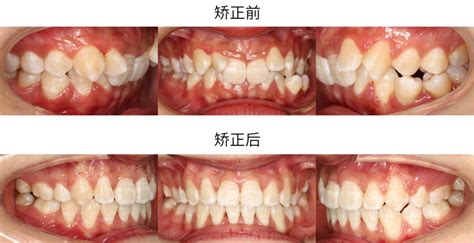 图片矫正(图片校正免费软件)缩略图