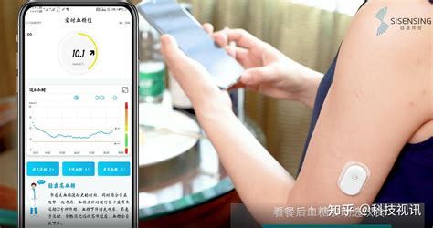 硅基动感(硅基动感动态血糖仪)缩略图
